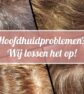 Hoofdhuidproblemen zoals psoriasis, seborroïsch eczeem of overmatige schilvering? Joolz Hairstyle lost het op!